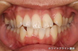 治療前
