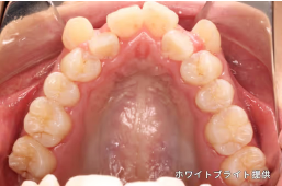 治療前